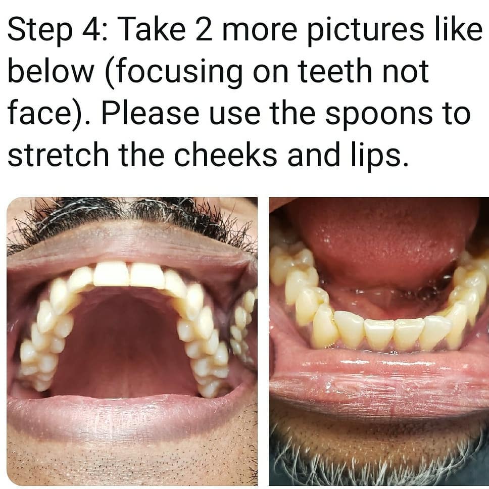 virtual top bottom