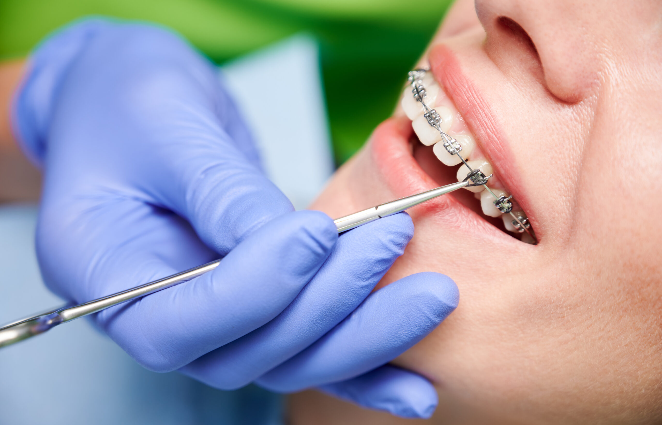 orthodontist near me