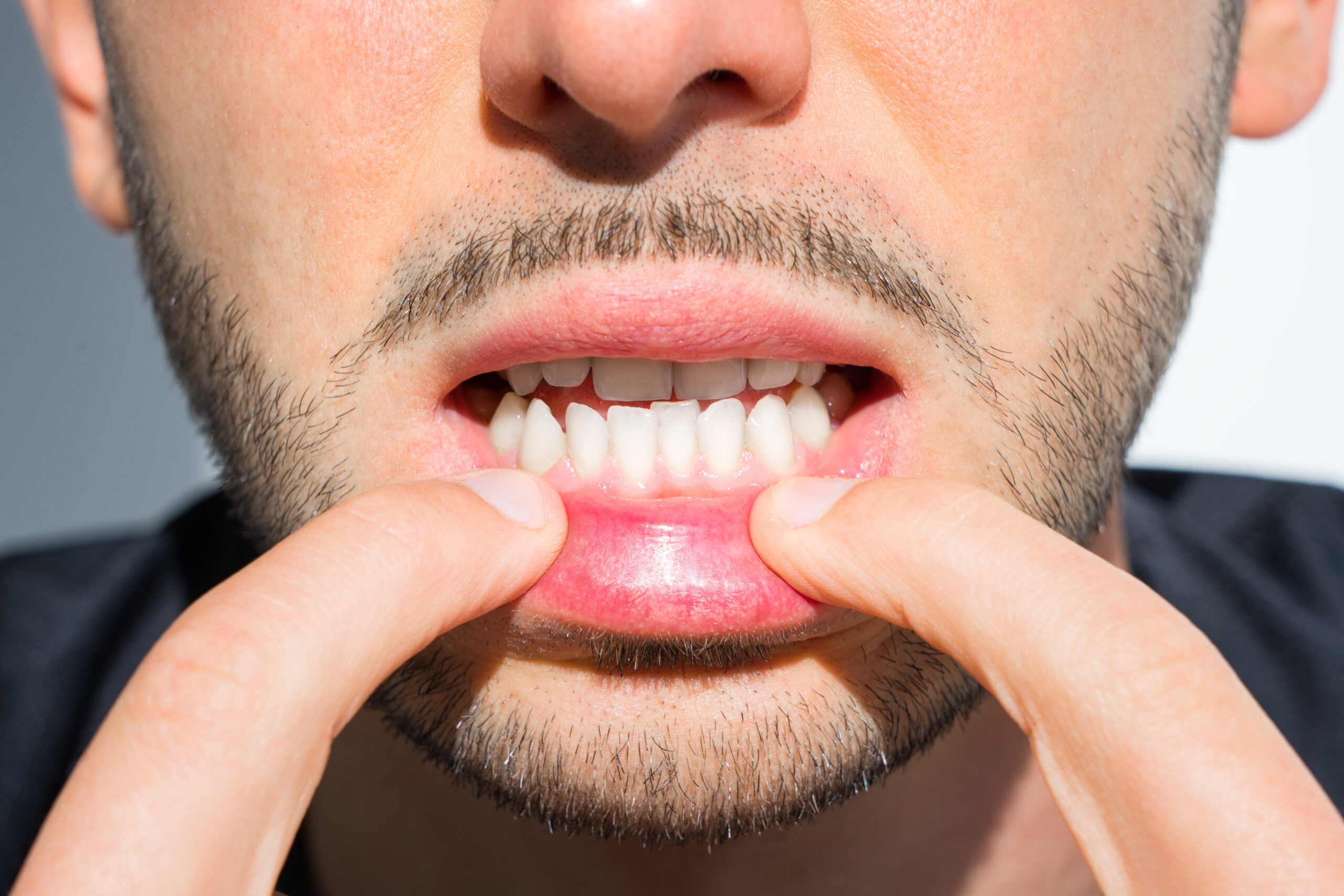 orthodontist in union city nj