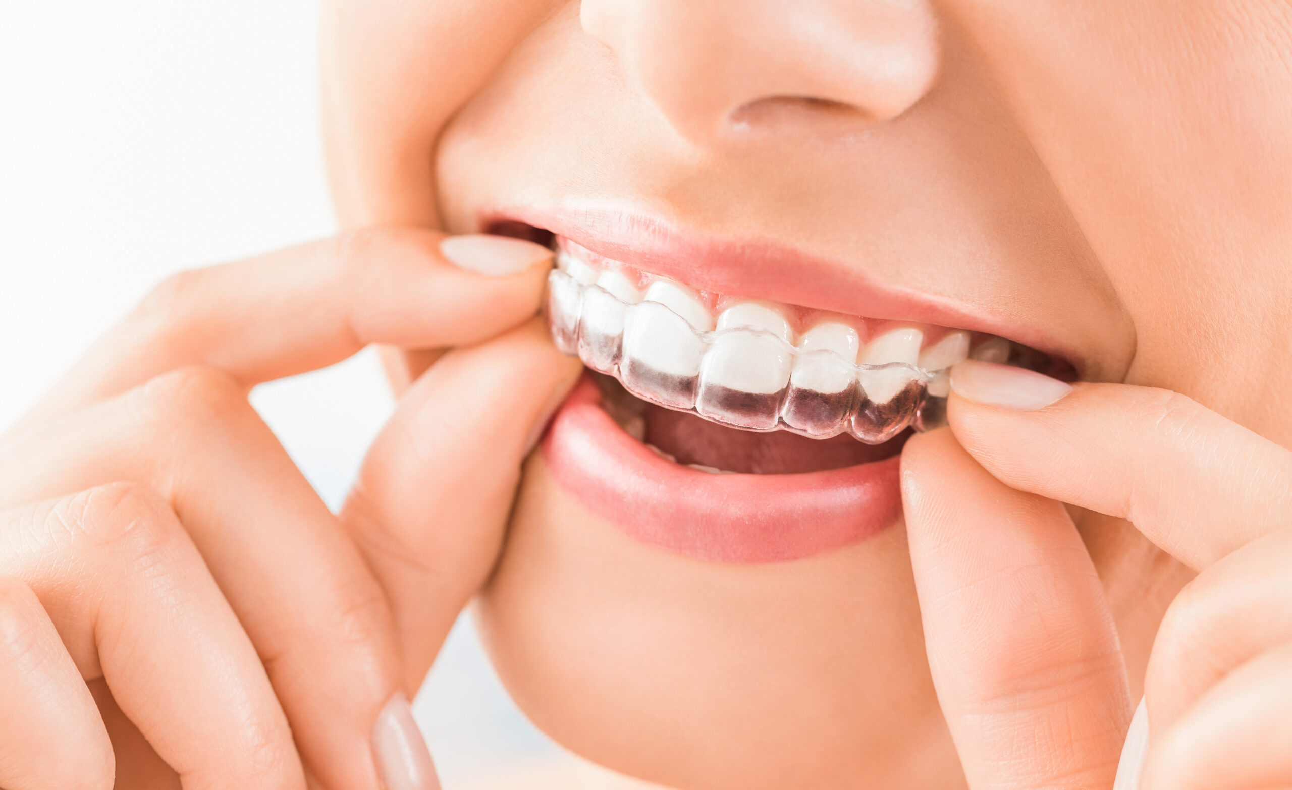 Invisalign aligners, New Jersey orthodontist